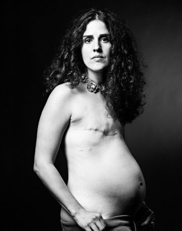 摄影师镜头记录乳腺癌患者重生影像