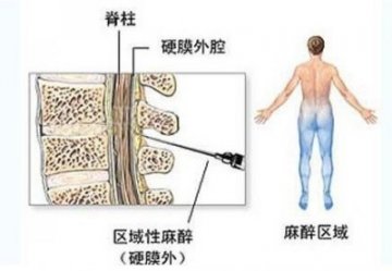 医学实录：女性剖腹产手术全过程