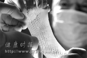 跨国皮肤移植术在武汉成功实施