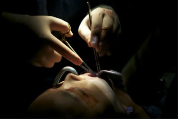 韩国摄影师记录5位模特血腥整容蜕变全程
