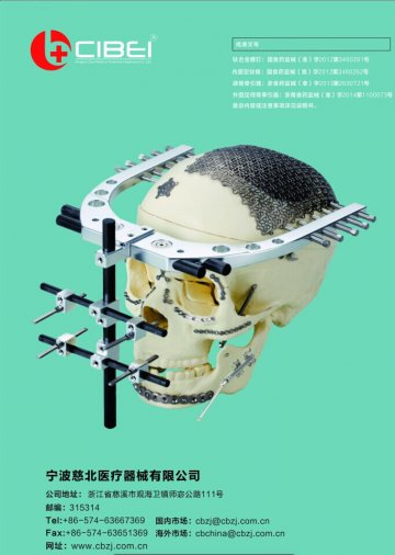 内固定钛板、钛合金螺钉、颌骨牵引器、外固定颅骨牵引器-内固定钛板、钛合金螺钉、颌骨牵引器、外固定颅骨牵引器官方高清创意广