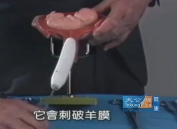实拍堕胎手术全过程 呼吁珍惜生命