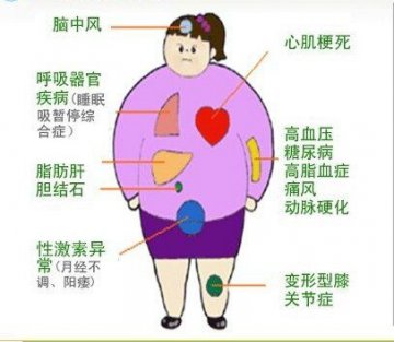 第306医院专家谈肥胖病人的手术麻醉