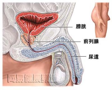 前列腺切除术