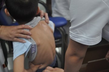 儿童敷三伏贴