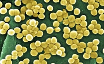 科学家发现一特殊细菌有抗药性 英美等国均感染