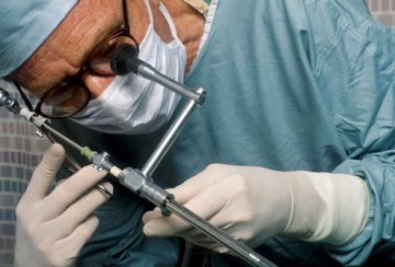 子宫内膜异位的诊断3：腹腔镜检查