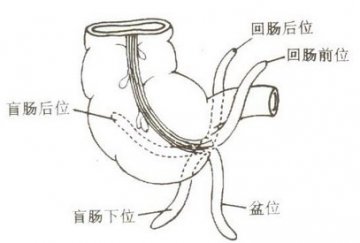 人体的12个“缺陷” 你发现了吗