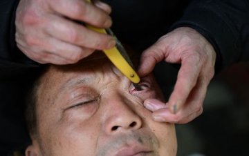 “刀锋洗眼”有健康风险