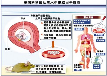 羊水成为干细胞提取新来源