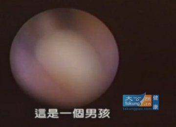 实拍堕胎手术全过程 呼吁珍惜生命