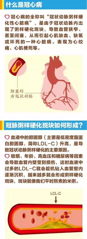 一图读懂冠心病是怎么发生的