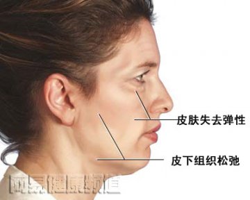 拉皮手术