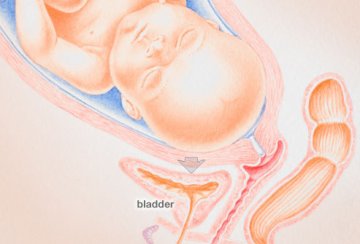 女性健康：女性应如何预防尿路感染