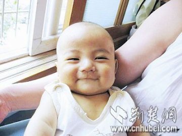 5个月宝宝肝移植 200多名“妈妈”帮忙筹款