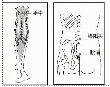 腰扭伤要活血通络