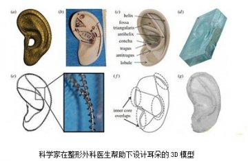 我国人工耳蜗市场综述