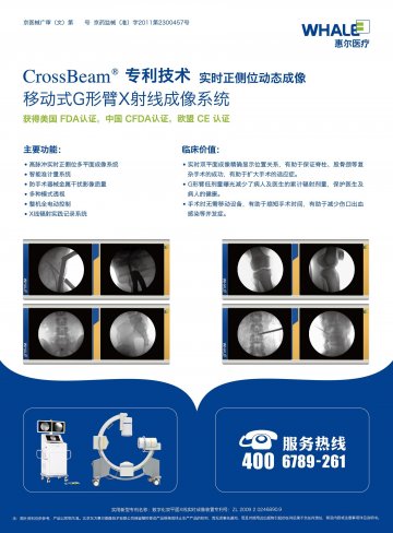移动式G形臂X射线成像系统-官方高清创意广告()