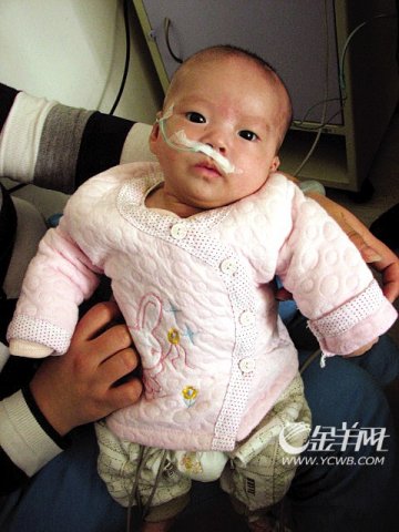 “先天心”女婴逃出“鬼门关”