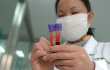 实拍：DNA亲子鉴定全过程