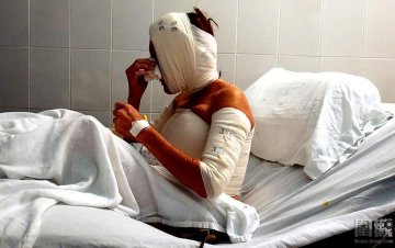 揭令人惊悚的廉价整容