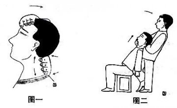 “白领一族”颈肩不适的推拿治疗及预防