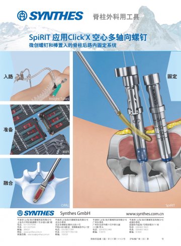 脊椎外科用工具-Synthes官方高清创意广告(沪医械广审(文)第2011050193号)