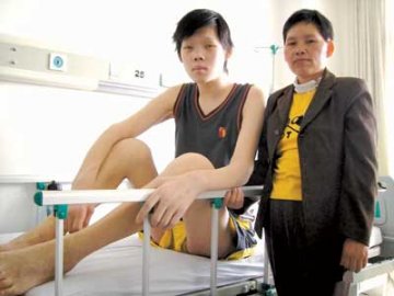 15岁女孩身高2.08米 患巨人症站立困难