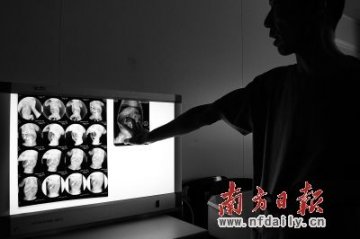 “缝肛门”、“八毛门”背后医患关系紧张的反思
