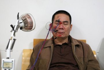 让世界认识中医
