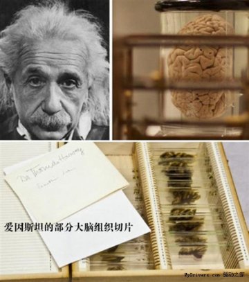 人体器官展：爱因斯坦大脑、伽利略手指