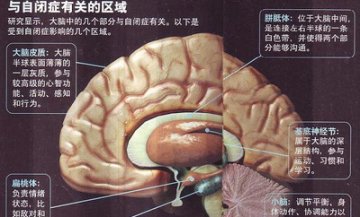 研究发现自闭症致病机理