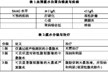 肝硬化腹水，“放水”+利尿双管齐下