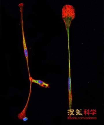 科学家利用抗体成功将骨髓干细胞变为脑细胞