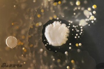 手机暗藏大量细菌 这是显微镜下的景象