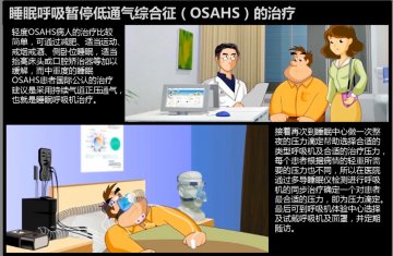 睡眠呼吸暂停低通气综合征