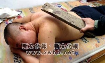 全球最恐怖的67种怪病