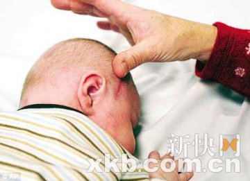 初生婴儿脑内发现异物原为一只小脚