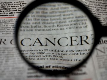 《Science》：多数癌症患者或要怪“运气不好”