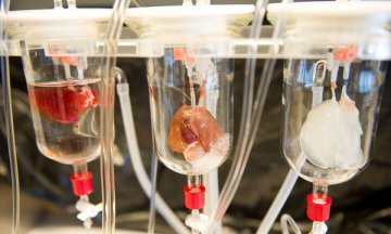 科学家用病人自身细胞订做器官