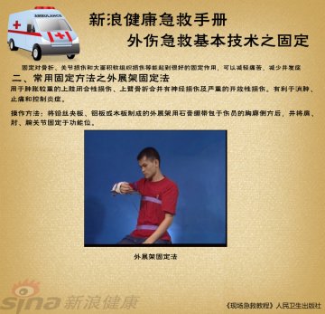 外展架固定法