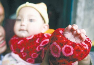 男婴患怪病长有8个手指11个脚趾