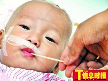幼儿体内发现6支钢针续：颅内取出约4厘米注射针