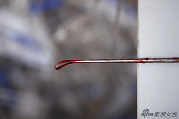 实拍少女人流全过程