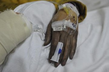 贵阳公交车燃烧事故伤员已送往医院救治