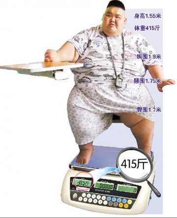 “中国第一胖”体检犯难 脂肪厚B超CT穿不透