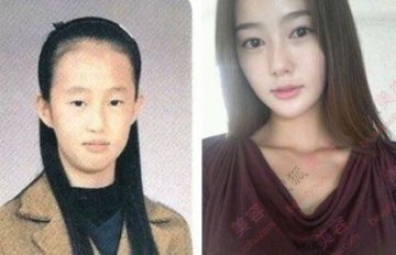31个惊人韩国整容案例