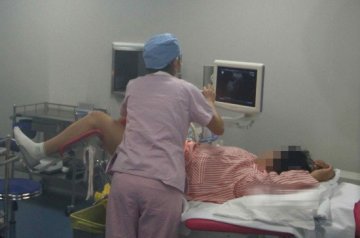 实拍试管婴儿取卵抽精过程