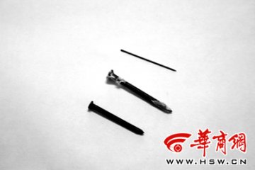 女童肚内频现铁钉 已排泄出17枚