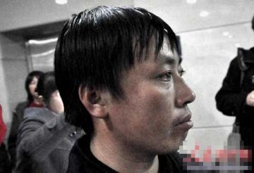 男孩心脏外露 全球不超百例